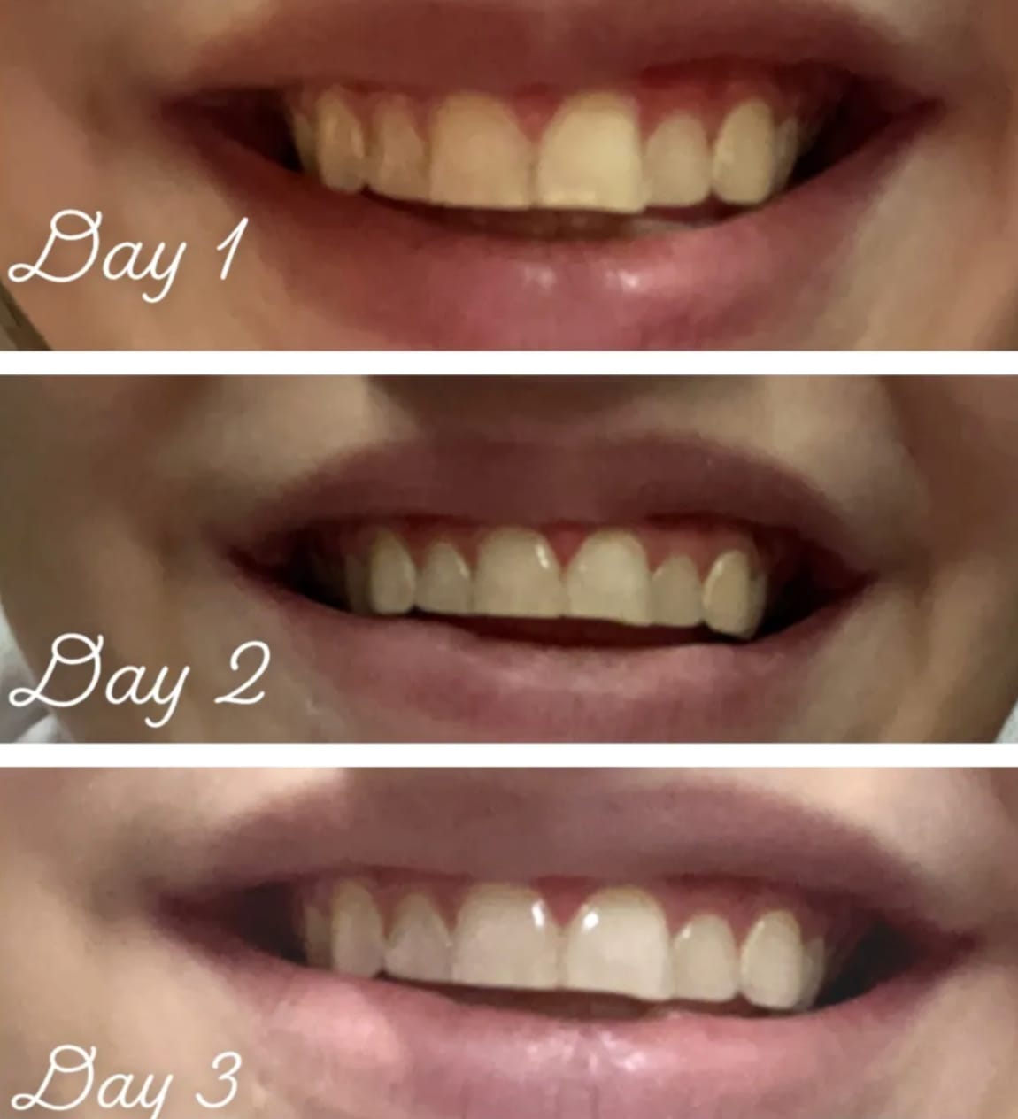 Customer photo review of Whitening & Care Duo