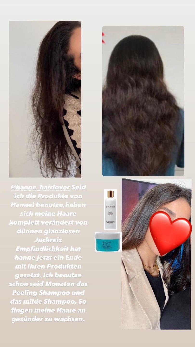 Customer photo review of Peeling Shampoo