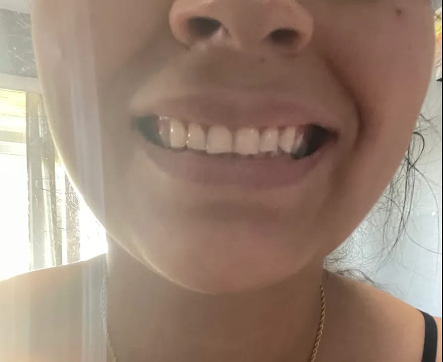 Customer photo review of Whitening & Care Duo