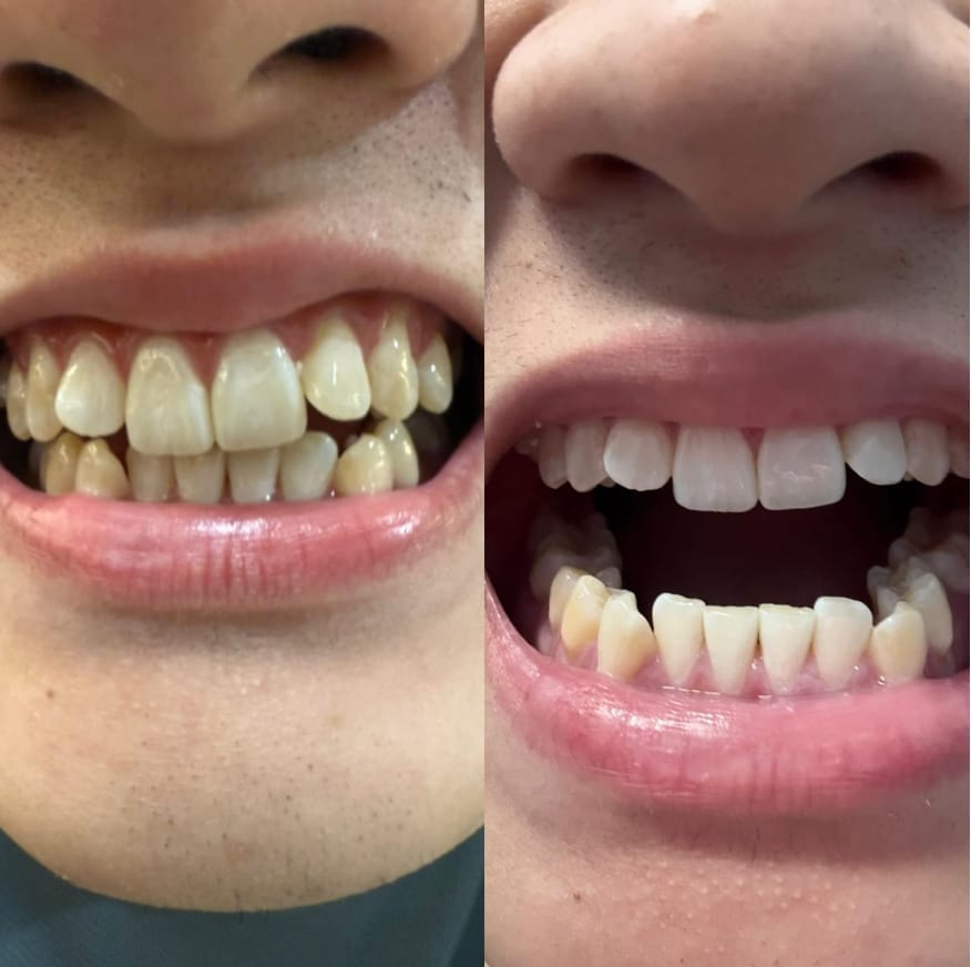 Customer photo review of Whitening & Care Duo