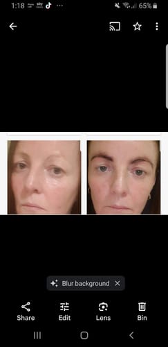 Customer photo review of iGlow Brow Maximizer - Brow Serum, 4 ml