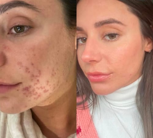 Customer photo review of Tisane Glow up ®