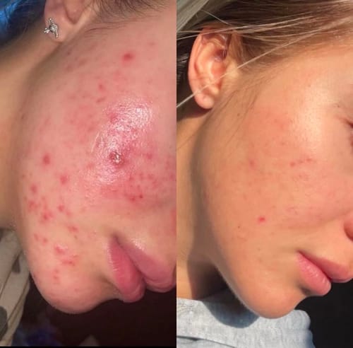 Customer photo review of Tisane Glow up ®