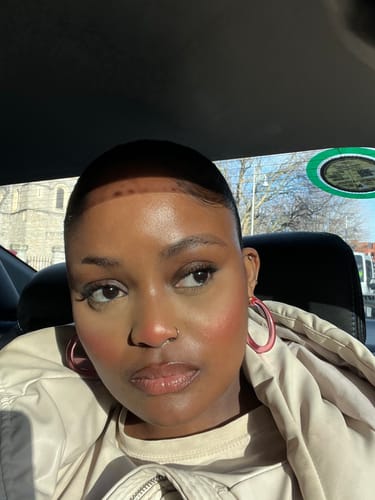 Customer photo review of Niacid