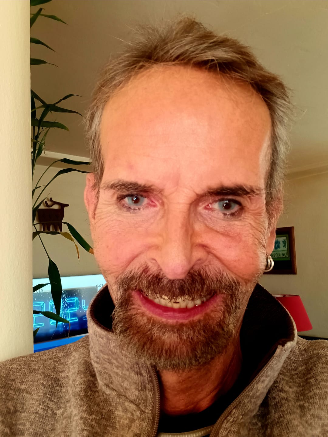 Customer photo review of Amazonia Antarctic Blue Prescription Colored Contact Lenses
