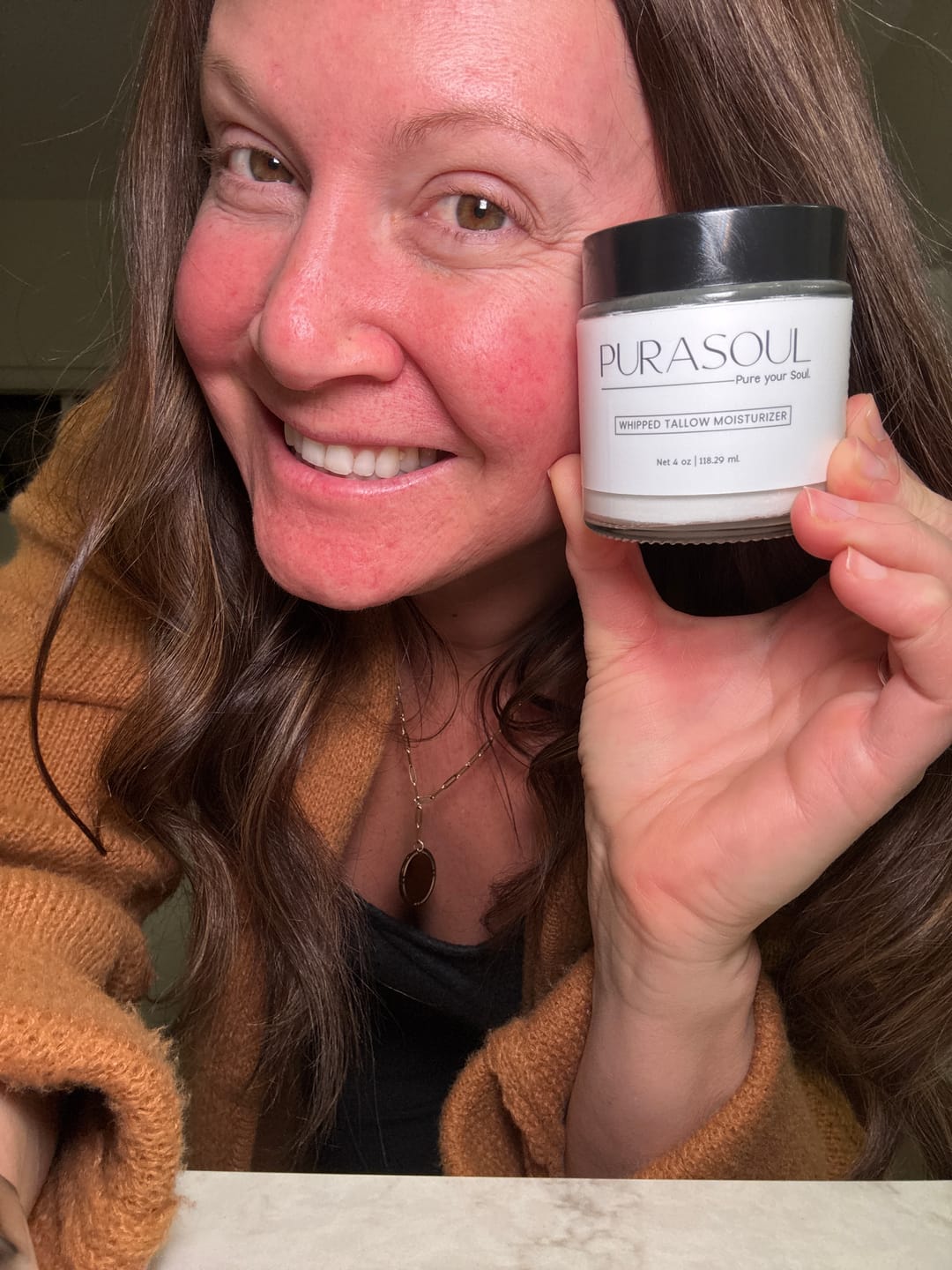 Customer photo review of Whipped Tallow Moisturizer