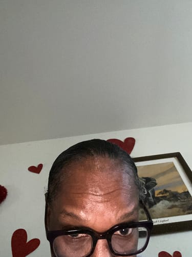 Customer photo review of Healthy Hair Starter Kit- Limited Edition