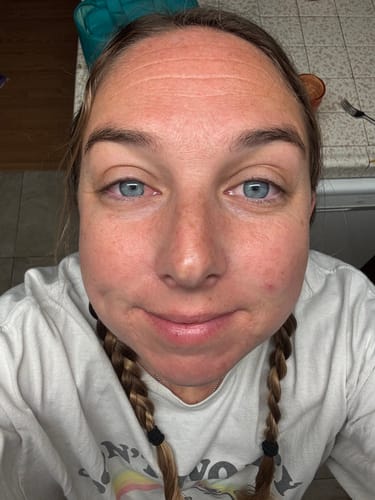 Customer photo review of Neptune Grass Fed Tallow & Honey Balm