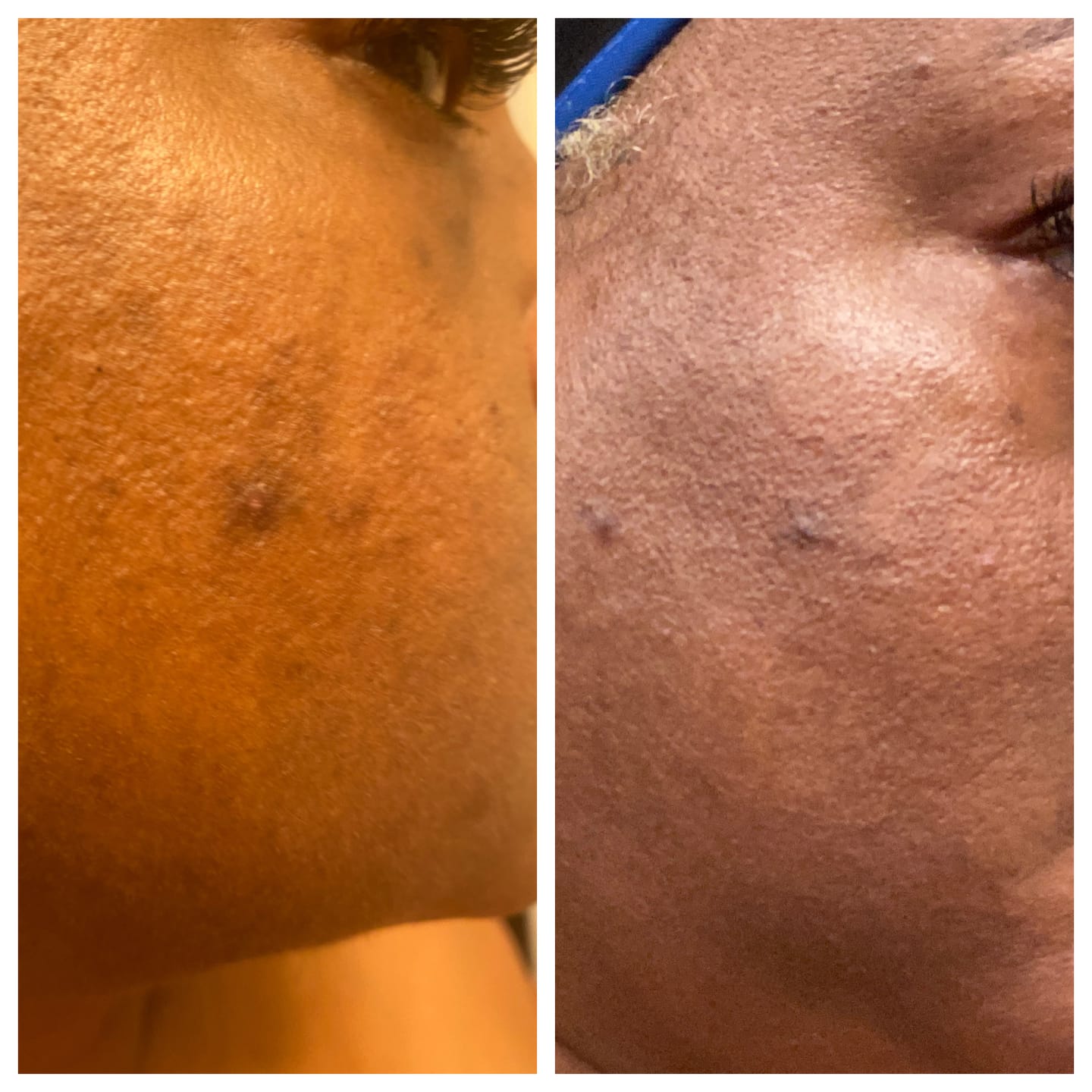 Customer photo review of Magic Eraser Dark Spot Cream