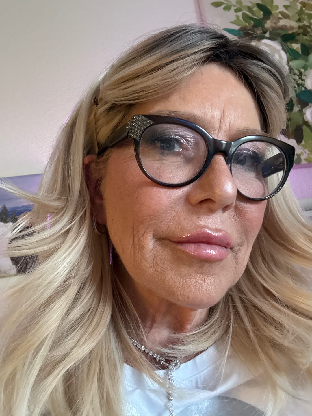 Customer photo review of Anti-Aging treatment