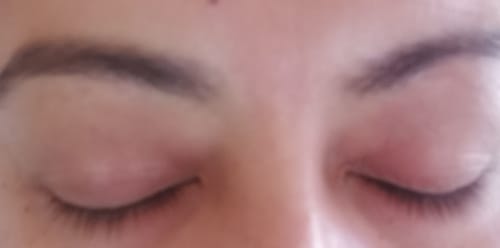 Customer photo review of Rapidlash® Eyelash Enhancing Serum