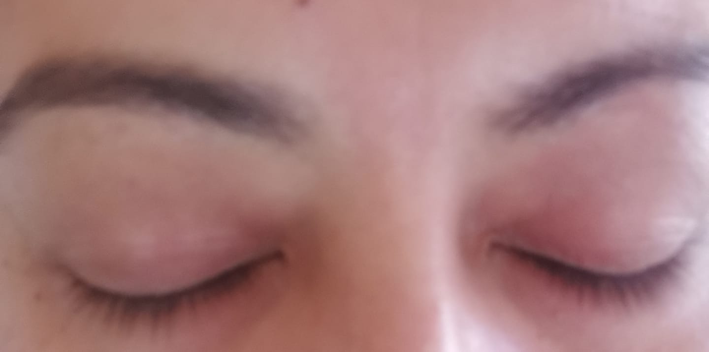 Customer photo review of Rapidlash® Eyelash Enhancing Serum
