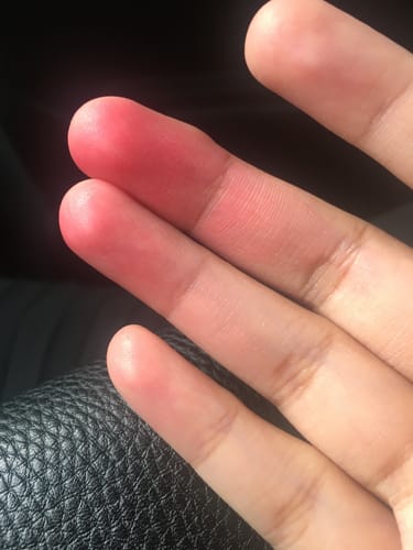 Customer photo review of mia