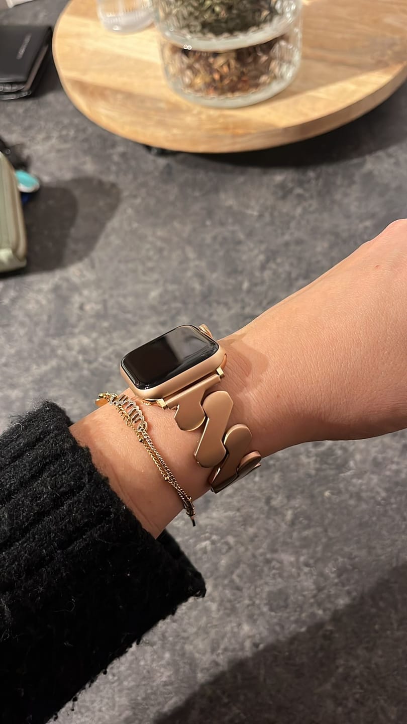 Customer photo review of Electra Stainless Strap
