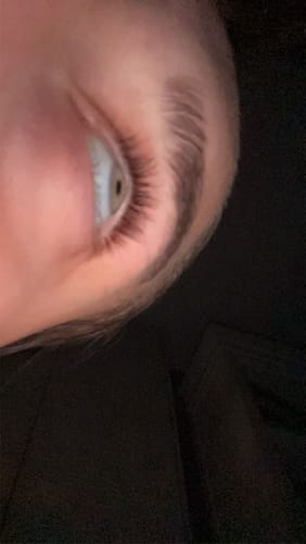 Customer photo review of iGlow Lash Maximizer - Lash Serum, 3 ml