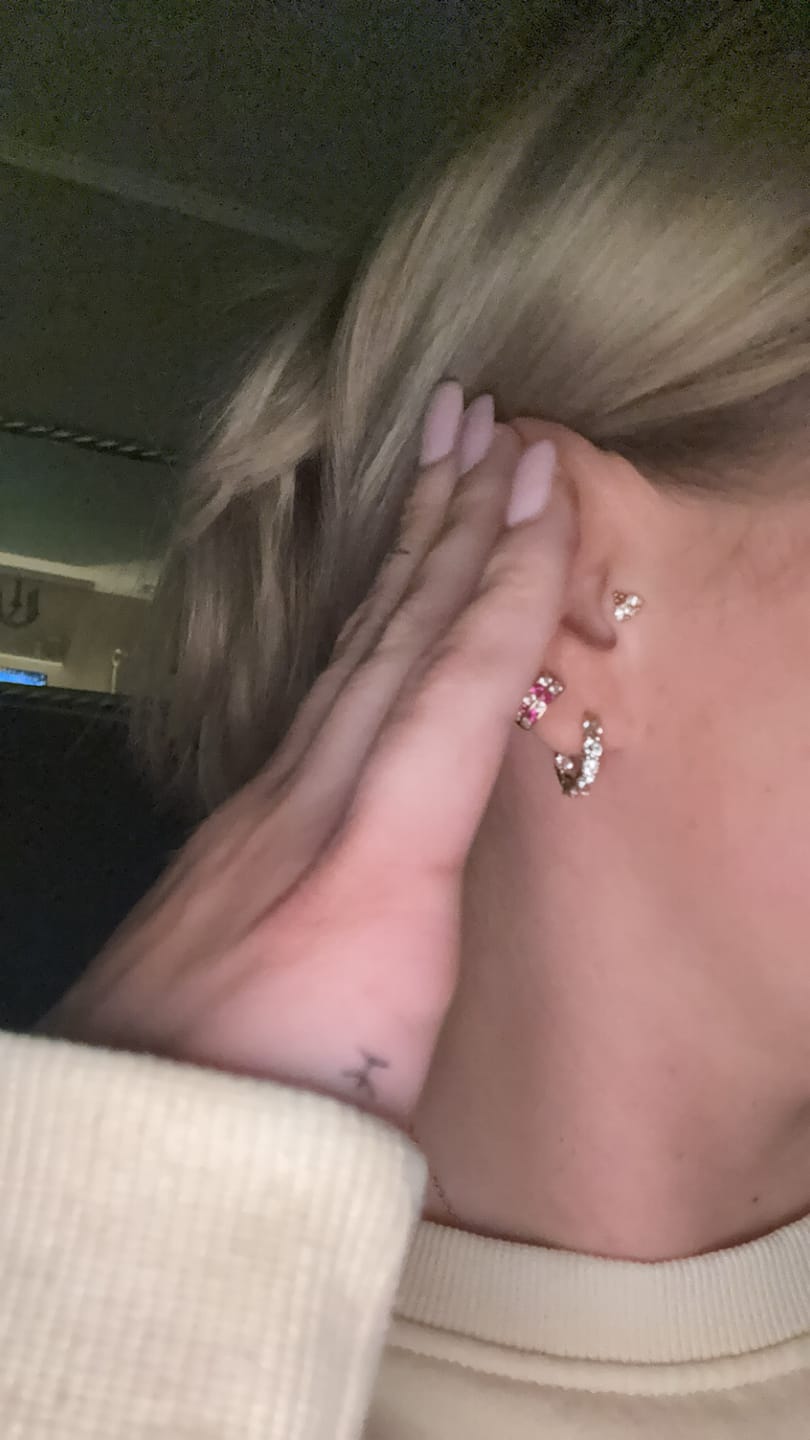 Customer photo review of Trinity Lotus Labret Piercing - Titan