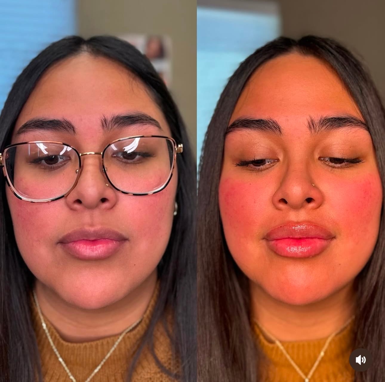 Customer photo review of Premium Lippen-Booster