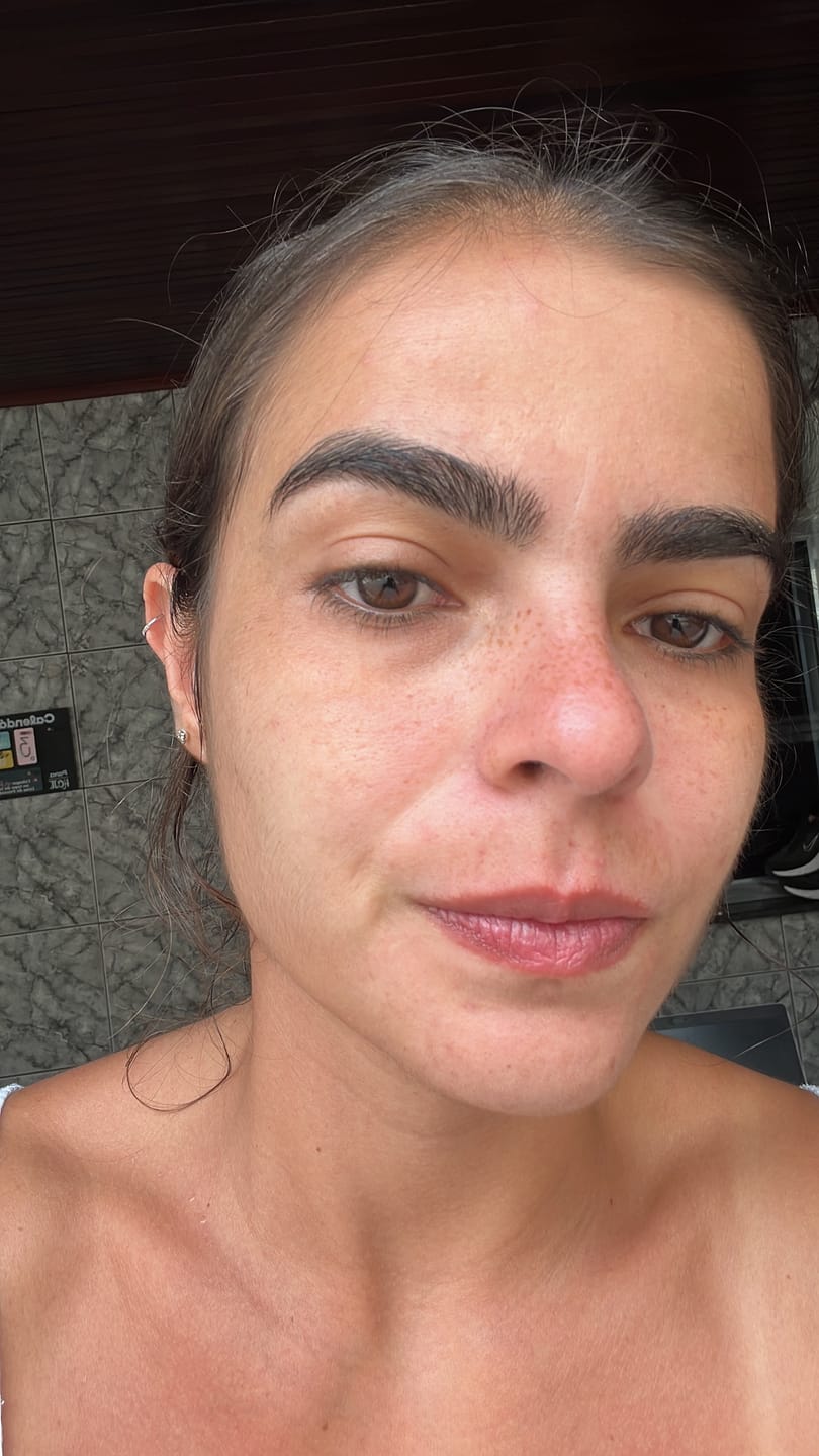 Customer photo review of Niacinamida + Retinol-Like