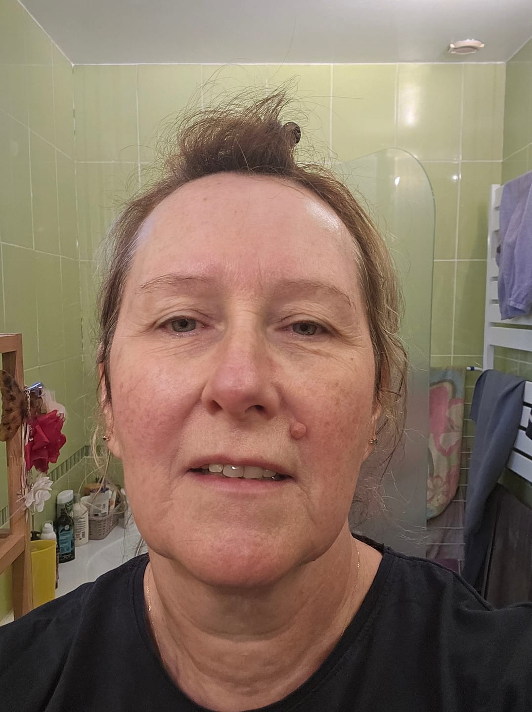 Customer photo review of BETULINA Crème pour le visage, 50ml