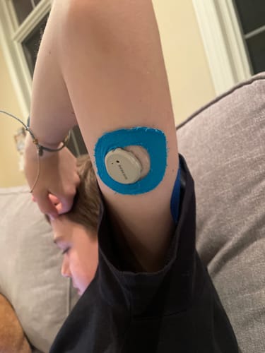 Customer photo review of Skin Grip Original - Dexcom G7 & Stelo Adhesive Patches (With Cutout)