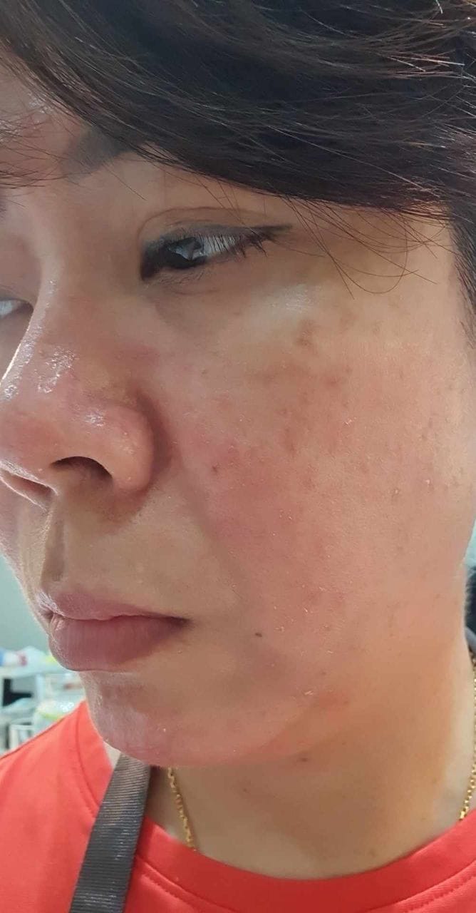Customer photo review of BeYoung Gut-Brain-Skin Booster