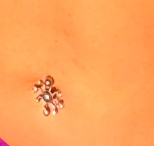 Customer photo review of Dermal Inspirations Navel Ring
