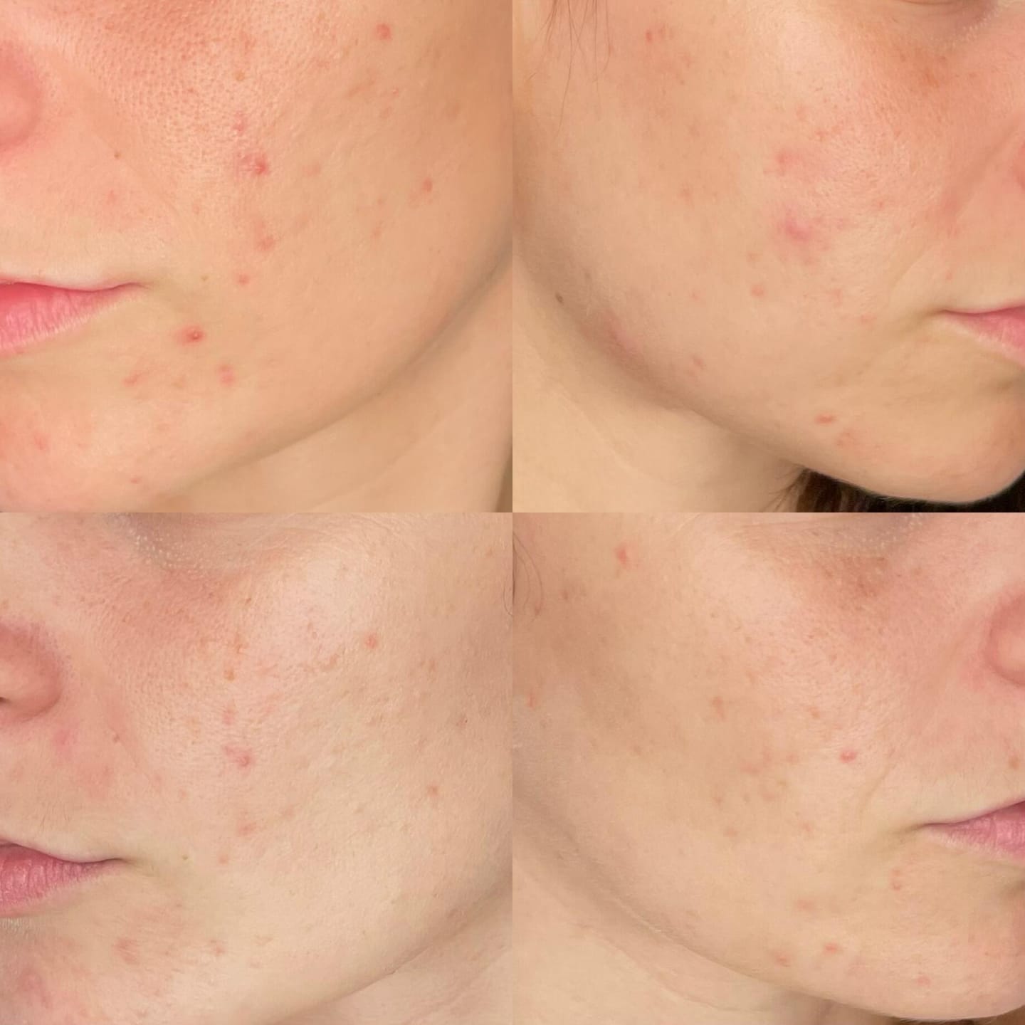 Customer photo review of A.O.X Booster Antioxidante con vitamina C