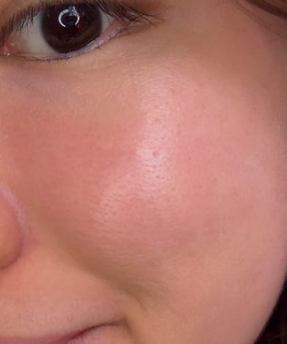 Customer photo review of Instant Pore Eraser