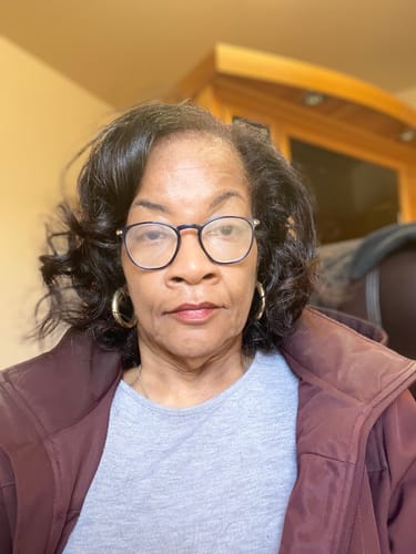 Customer photo review of Semaglutide Weight Loss Program Three Months