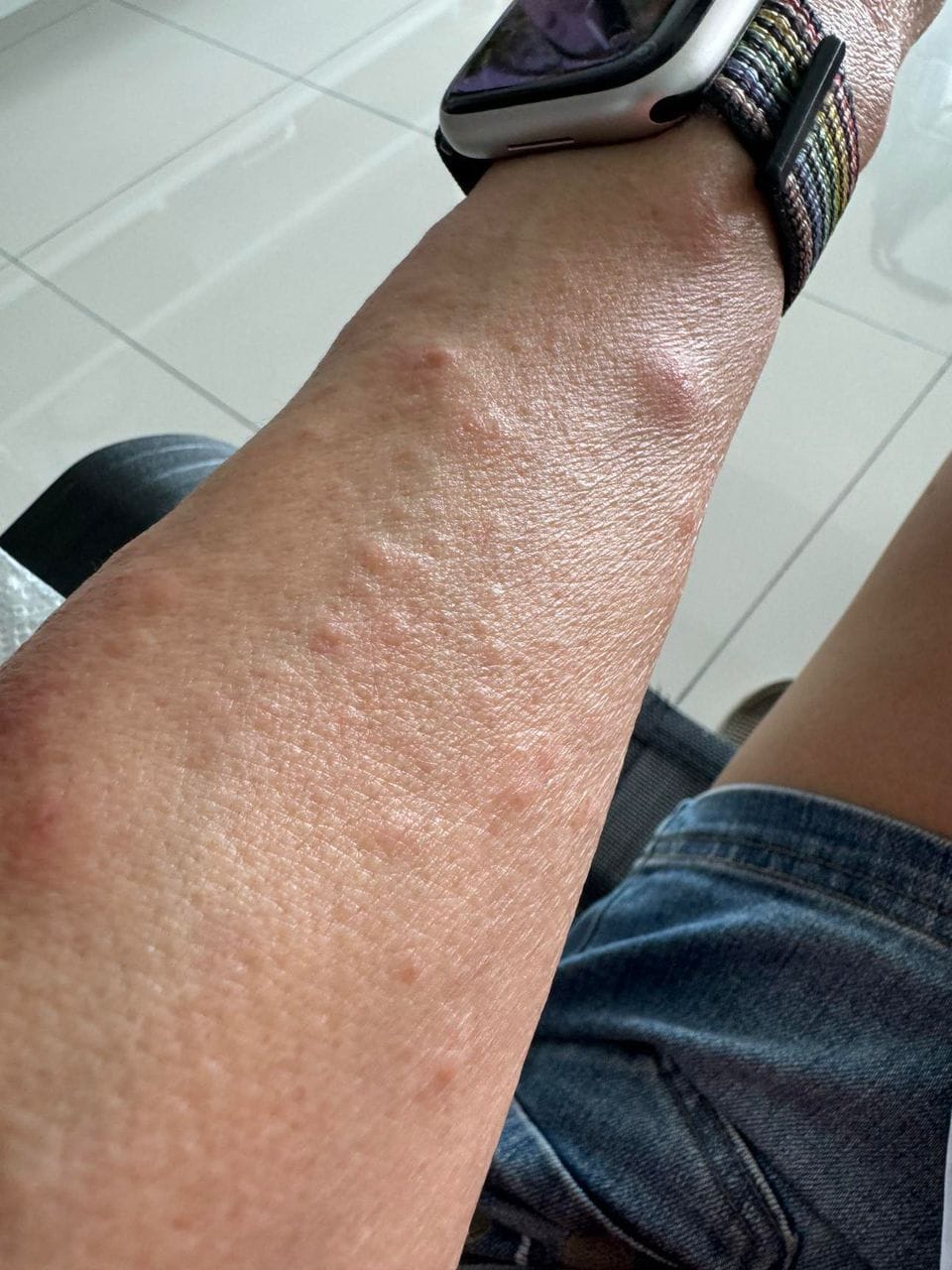 Customer photo review of BeYoung Gut-Brain-Skin Booster