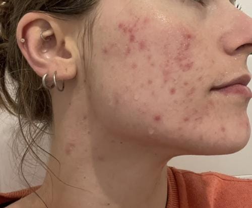 Customer photo review of Honey & Turmeric