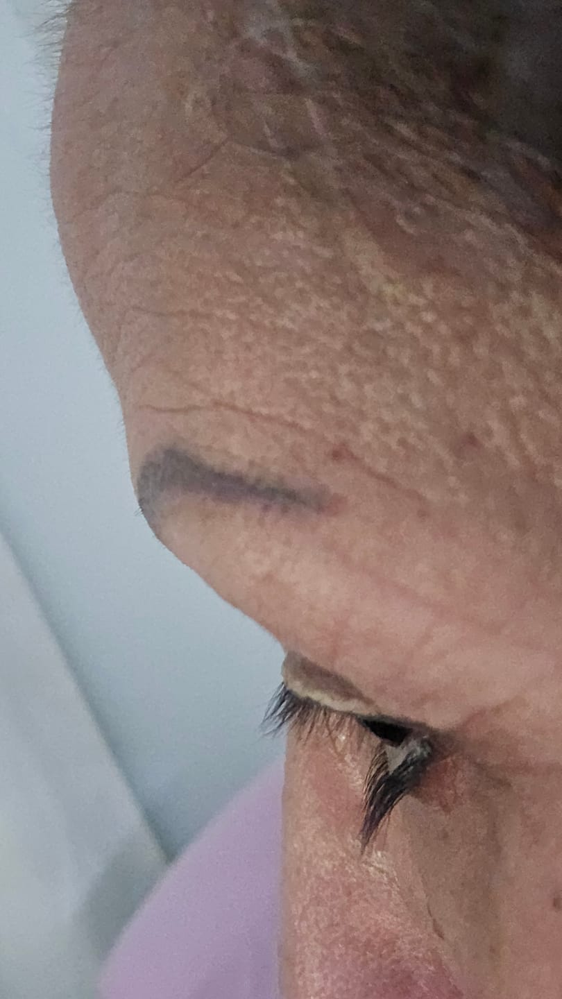Customer photo review of fLASH EYELASH SERUM