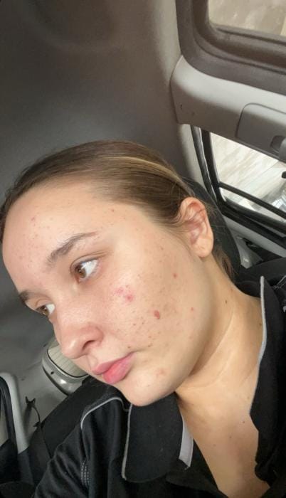 Customer photo review of Honey & Turmeric