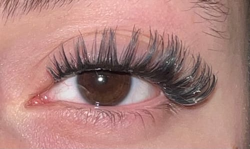 Customer photo review of THE STAR STARTER KIT (10mm-12mm)