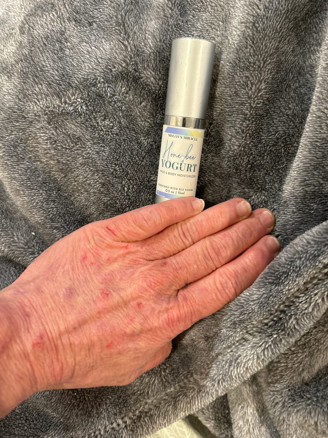 Customer photo review of Honeybee Toner Spray