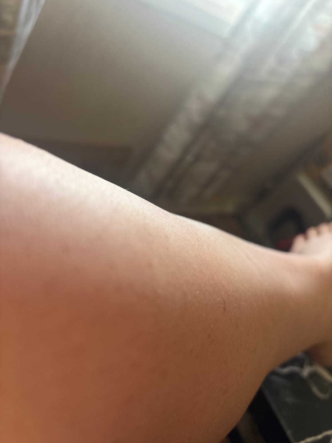 Customer photo review of ILUUMI IPL *CHRISTMAS SALE*