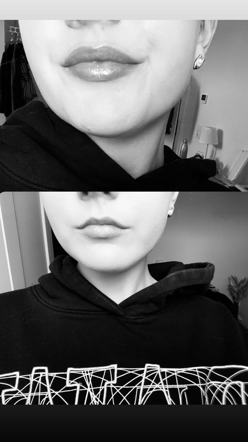 Customer photo review of Premium Lippen-Booster