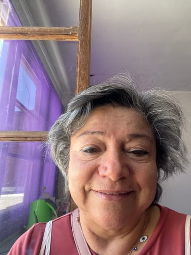 Customer photo review of Realiv - Contorno de ojos