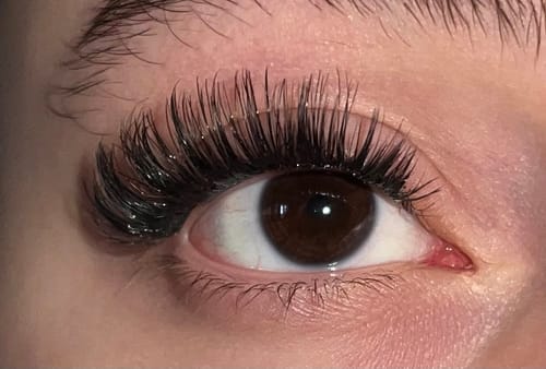 Customer photo review of THE STAR STARTER KIT (10mm-12mm)