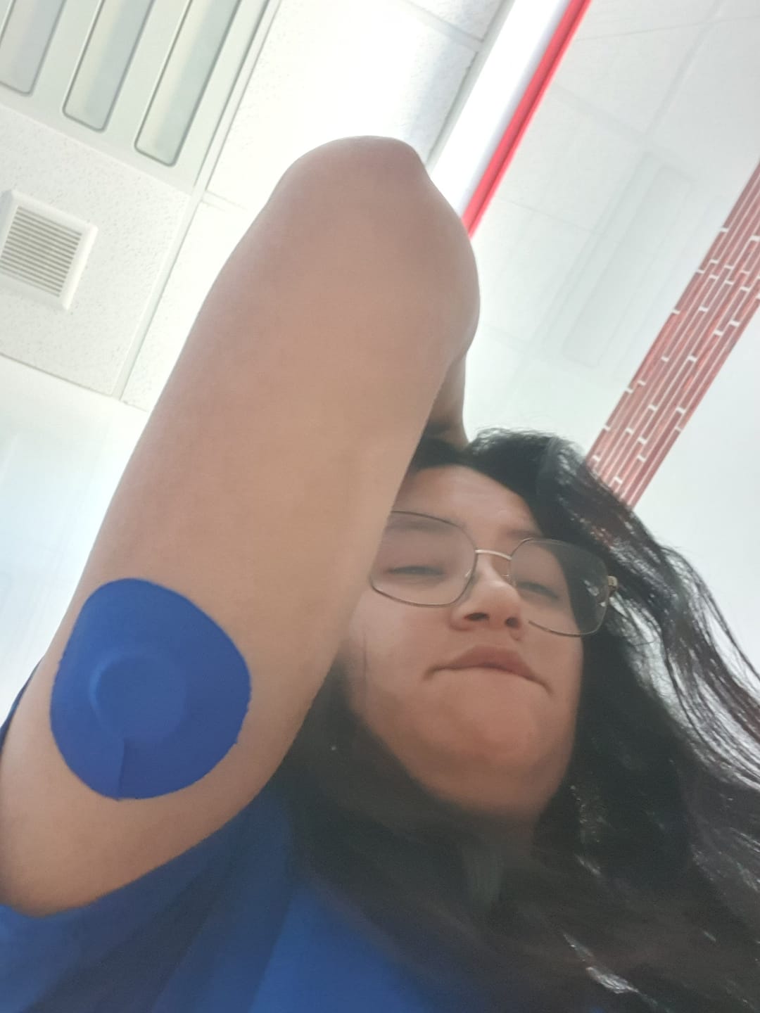 Customer photo review of Skin Grip Original - Freestyle Libre 2 & Lingo Adhesive Patches