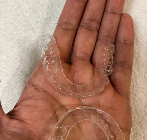 Customer photo review of File Your Smile (A Digital Copy of Your Impressions For Future Replacement Products)