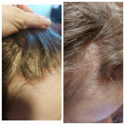 Customer photo review of Sereni Pikkelysömör és Ekcéma Sampon