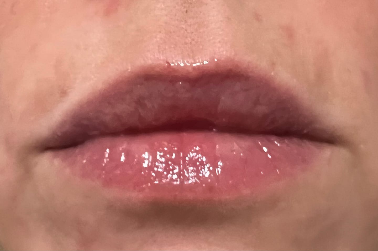 Customer photo review of Premium Lippen-Booster
