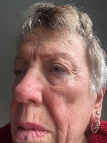 Customer photo review of The Complete System for Mature Women’s Skin