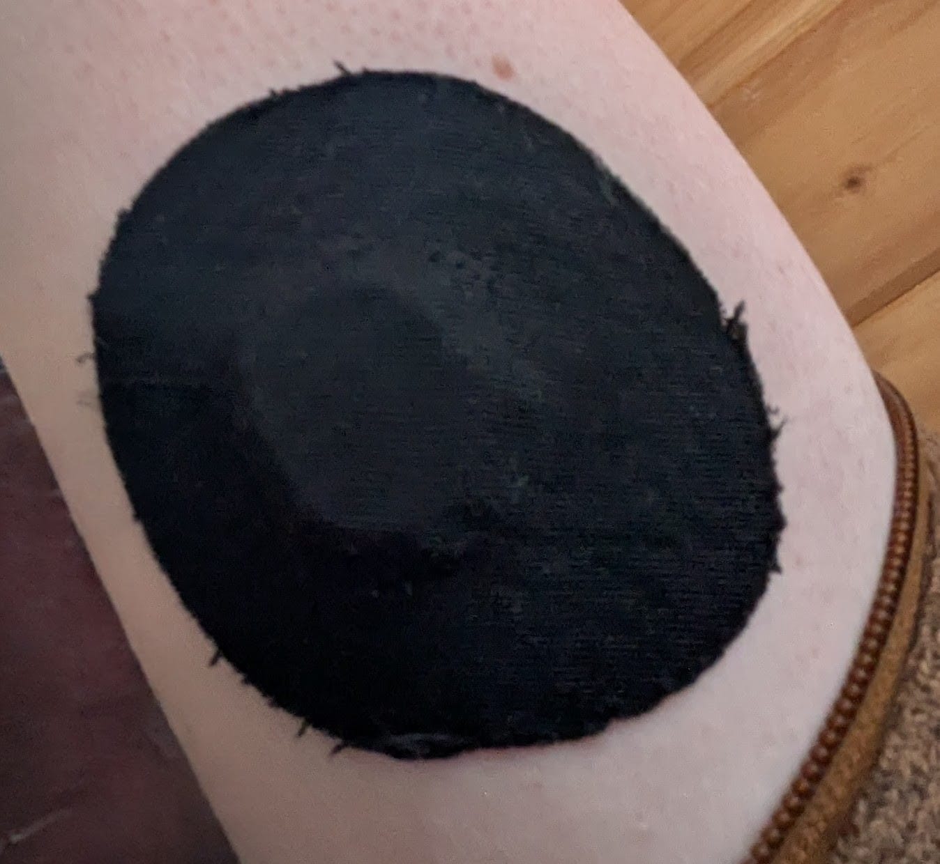 Customer photo review of Skin Grip Original - Dexcom G7 & Stelo Adhesive Patches