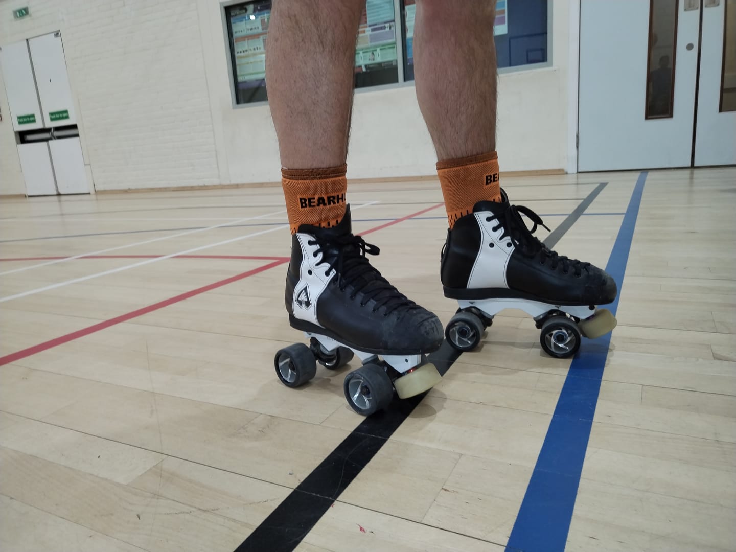 Customer photo review of Pair of Ankle Compression Support Sleeves For Achilles Tendon and Ankle Sprains