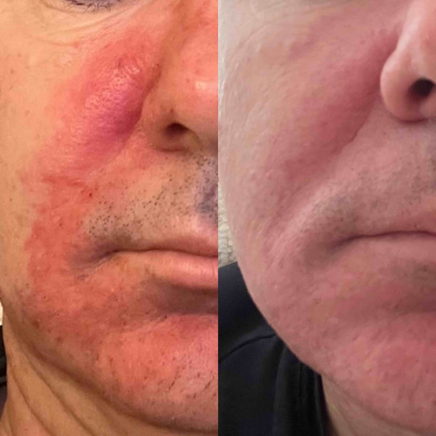 Customer photo review of Sea Cucumber Collagen Sensitive Skin Pack