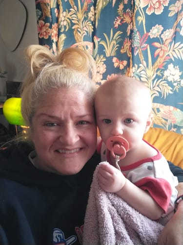 Customer photo review of Neptune Grass Fed Tallow & Honey Balm