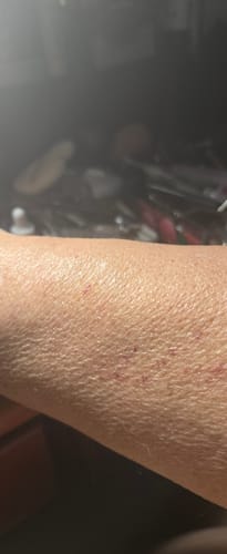 Customer photo review of Glov Micro Infusion System