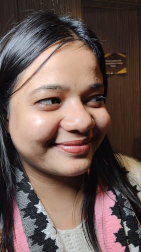 Customer photo review of GlowEase 2 in 1 Cleanser & Mask